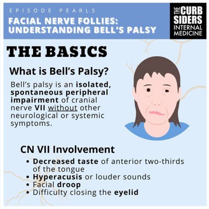What is the best medicine for Bells palsy