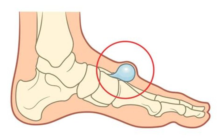 What is the bone on top of your foot called