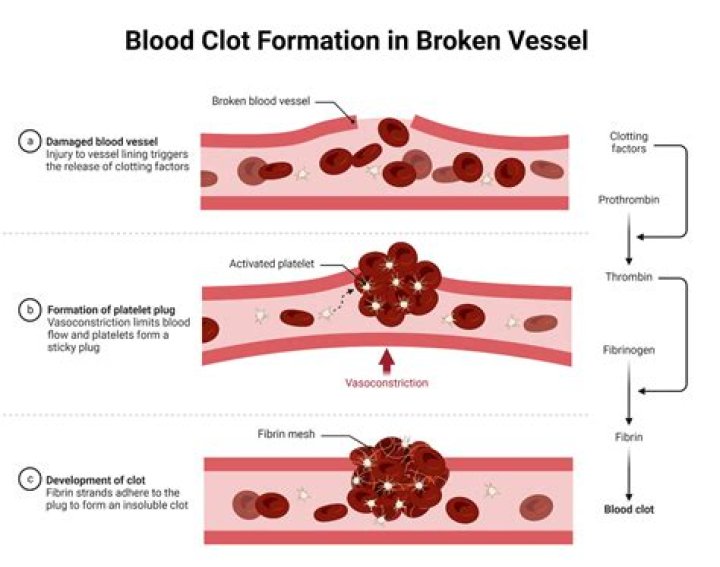 What is the cause of hemostasis