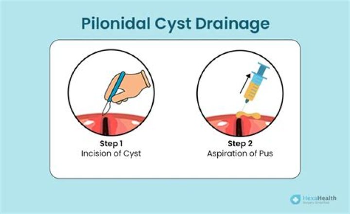 What is the CPT code for incision and drainage of perianal abscess