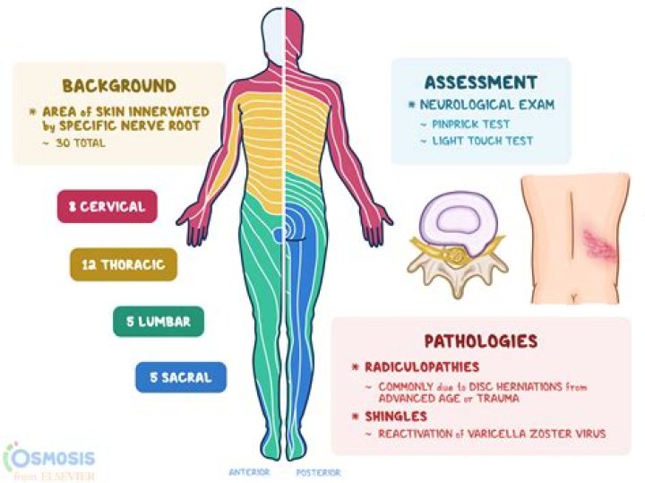 What is the CPT code for lower back pain