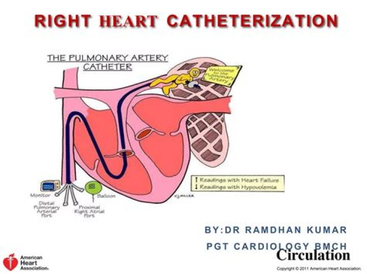 What is the difference between a right heart cath and a left heart cath