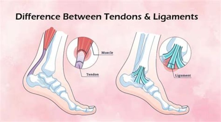 What is the difference between a tendon and ligament