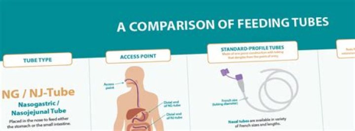 What is the difference between tube feeding and TPN