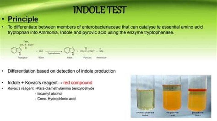 What is the indole test used for in microbiology