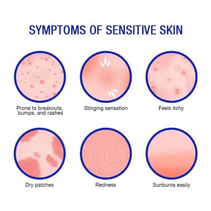 What is the most sensitive flower