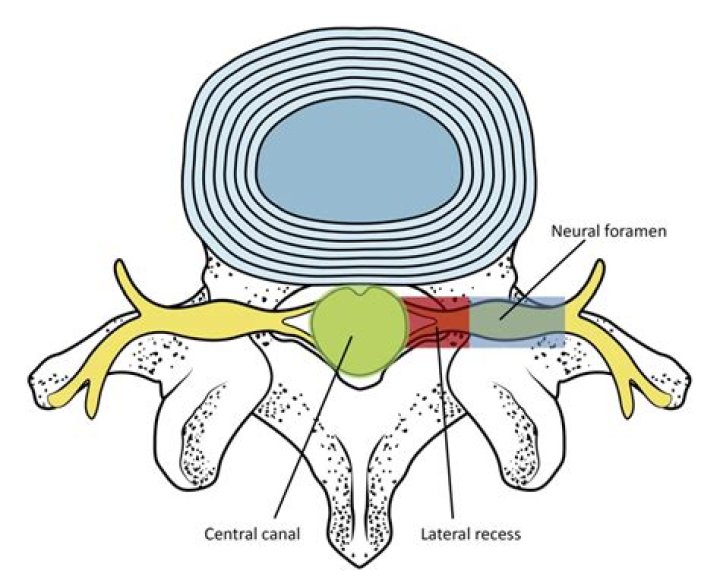 What is the normal size of spinal canal