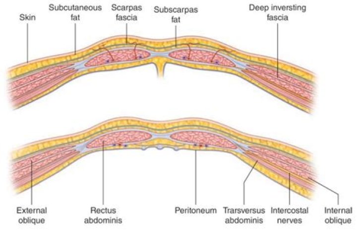 What is the posterior rectus sheath made up of above the arcuate line