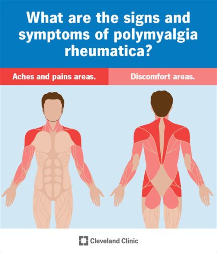 What is the prognosis for polymyalgia rheumatica