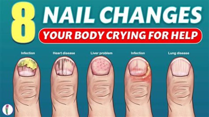 What is the reason the nail bed appears pink