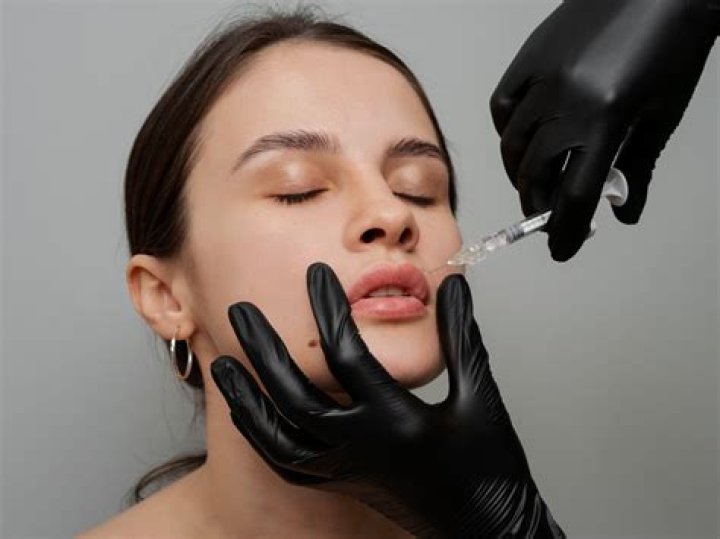 What is the side effect of filler injection