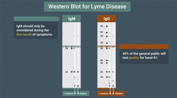 What is the test for Lyme disease