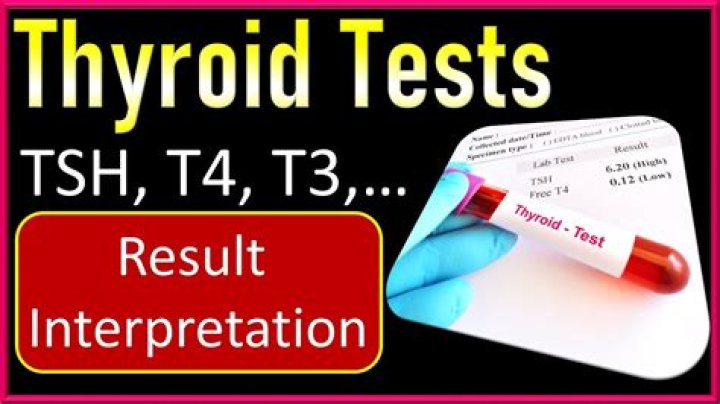 What makes up the Thyroid Hormone quizlet