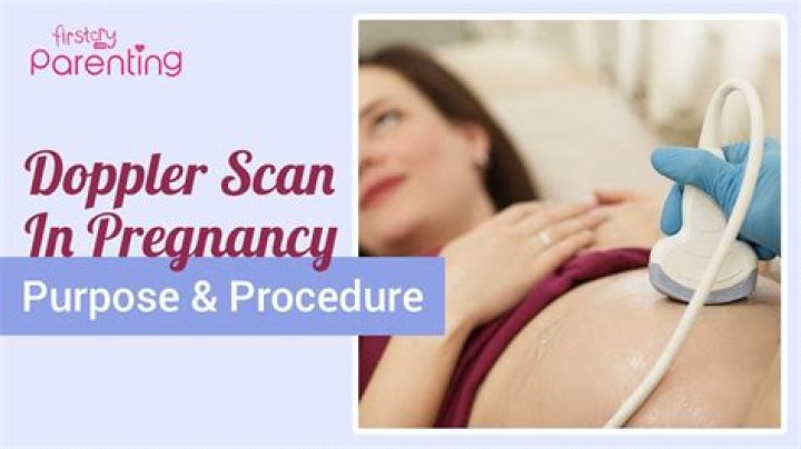 When is Doppler scan done in pregnancy