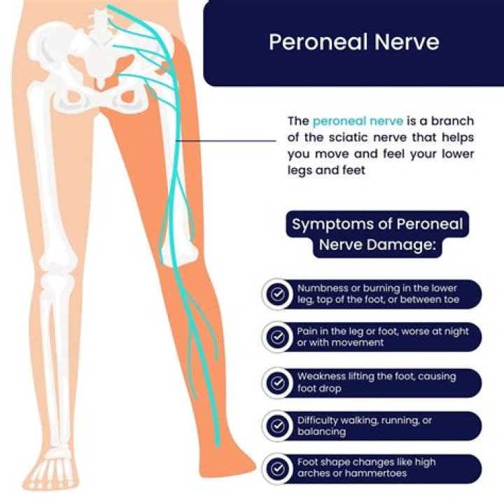 Where does the common peroneal nerve bifurcation