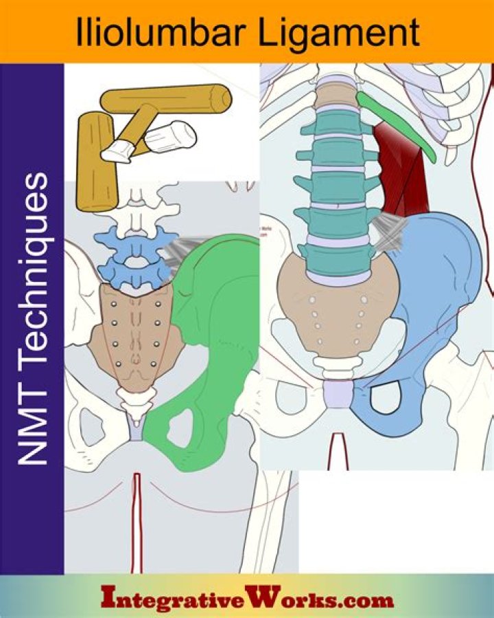 Where does the Iliolumbar ligament attach