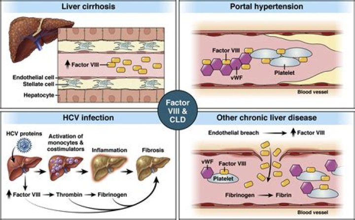 Where is factor VIII produced