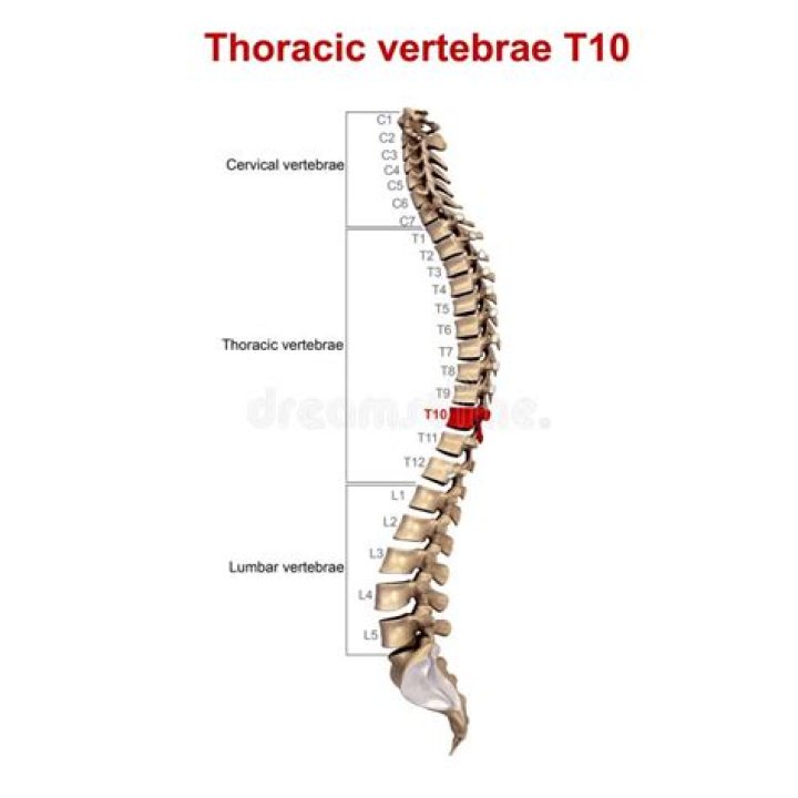 Where is t10 on the spine