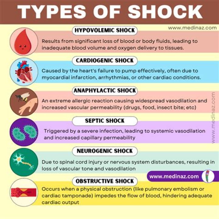 Which of the following is a common sign of hypovolemic shock