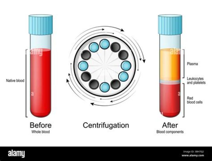 Which organelle would pellet first during centrifugation