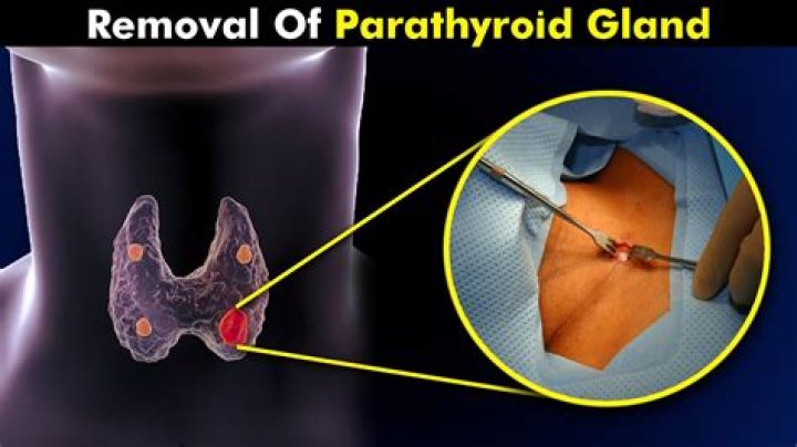 Who discovered parathyroid glands