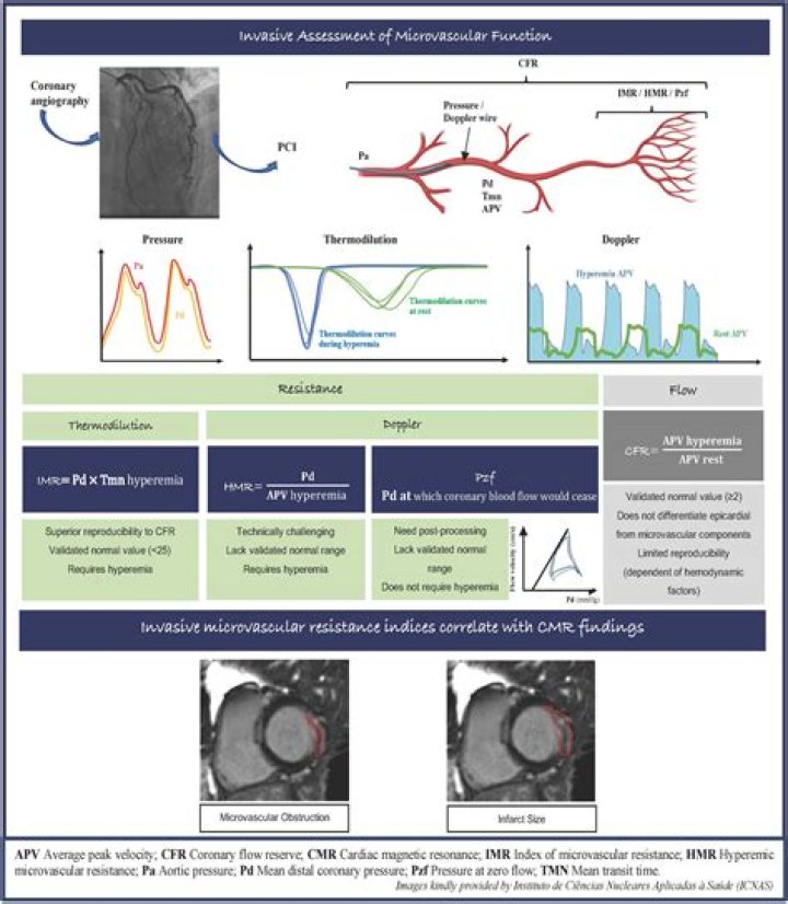 Who performs coronary angiography