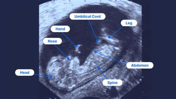 Why do people do ultrasounds