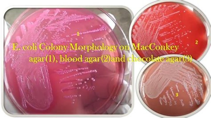 Why does E coli grow on EMB