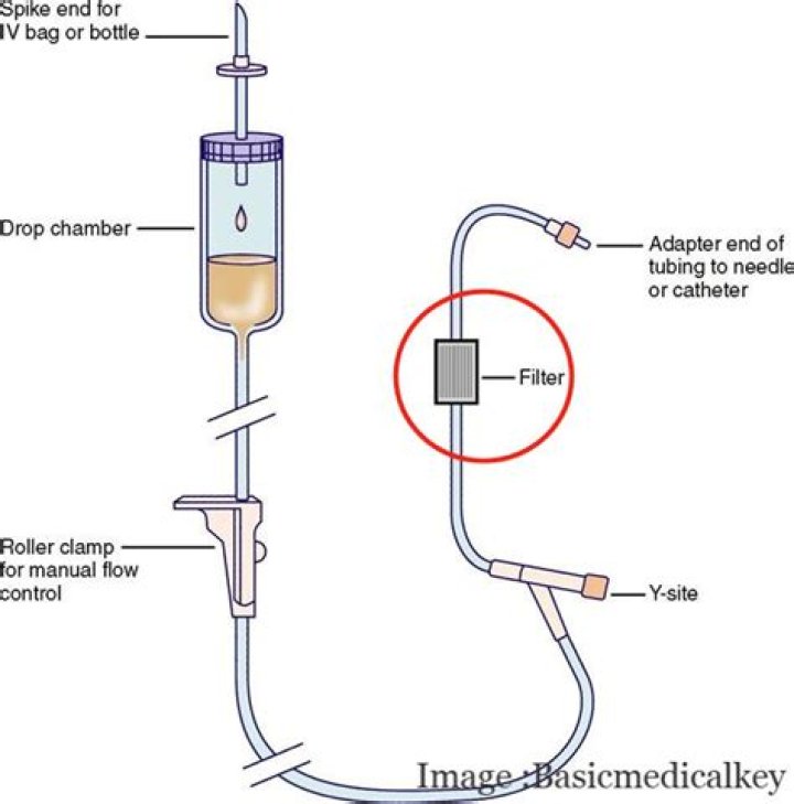 Why is a filter needed for TPN