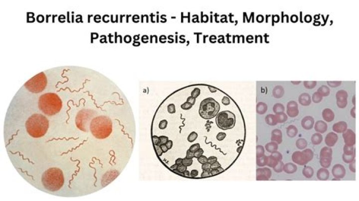 Why is Borrelia burgdorferi Gram positive or negative