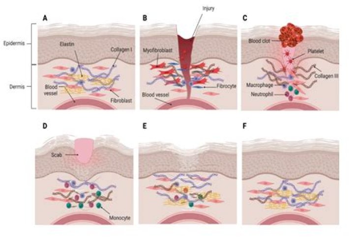 Why is collagen important in wound healing