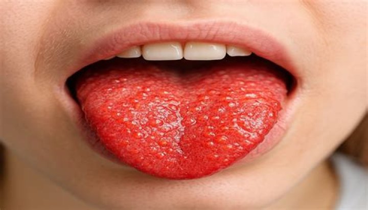 Why is it called Strawberry Cough