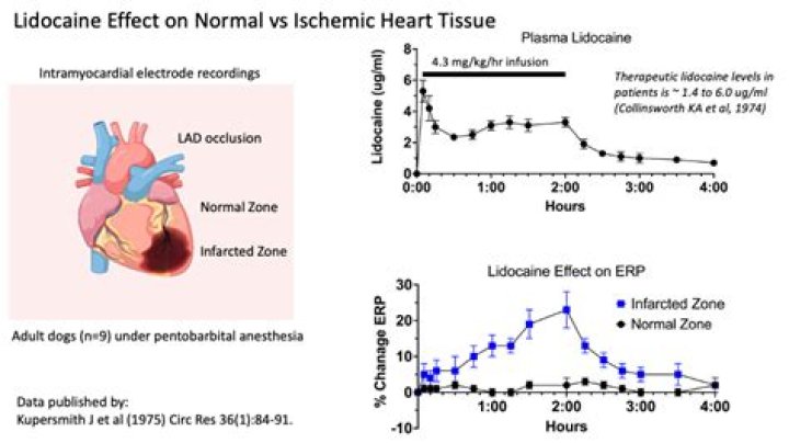 Why is lidocaine used for arrhythmias