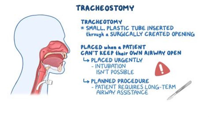 Why would someone need a thoracotomy