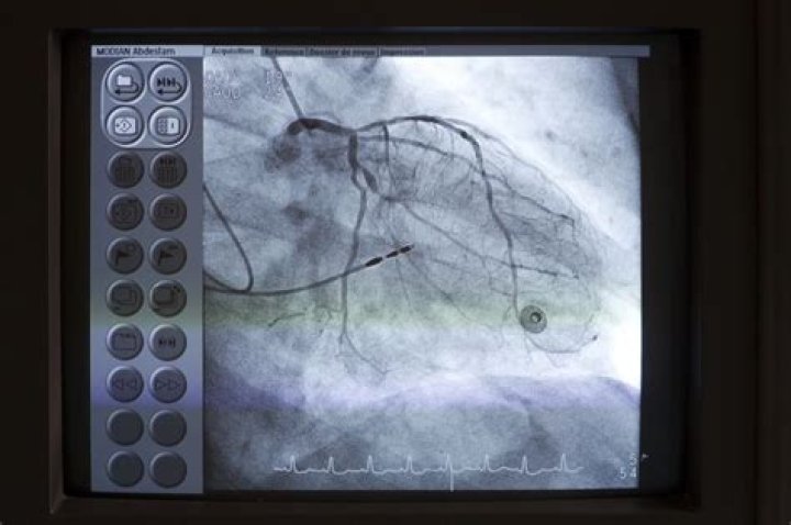 Why would you need a heart catheterization