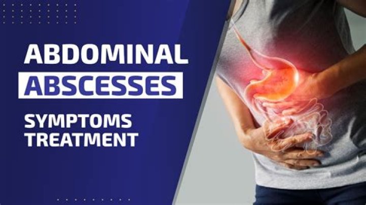 Will antibiotics make an abscess go away