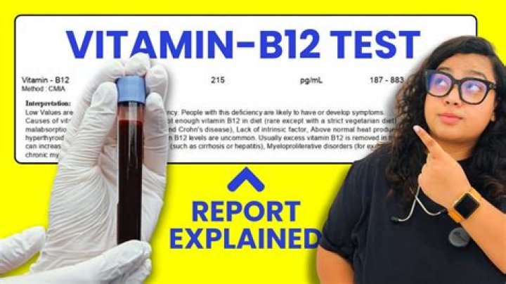 Will vitamin B12 fail a drug test